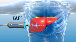 liver